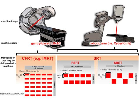 Ebrt Therapy - All About Radiation