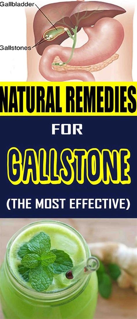 Natural Remedies For Gallstone (The Most Effective) | Natural remedies ...