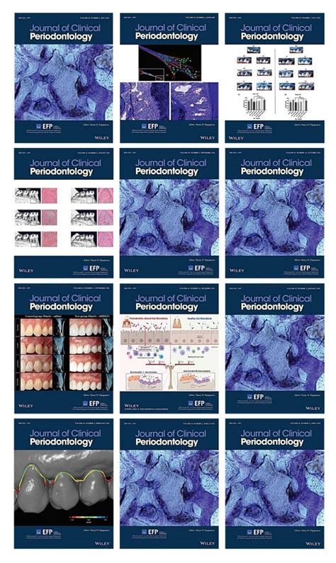 Journal of Clinical Periodontology 2022 Full Archives (True PDF) - Afkebooks - Medical ebooks ...