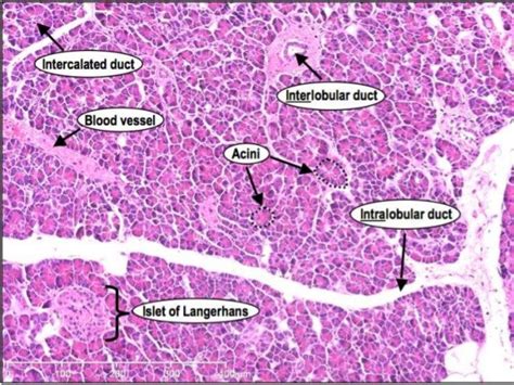 Image result for islets of langerhans histology | Histology slides, Pancreas, Medical laboratory ...