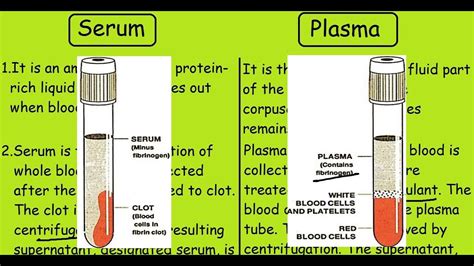 How Can You Visually Tell Serum From Plasma? - Capa Learning