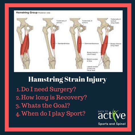 Pulled Hamstring Diagram