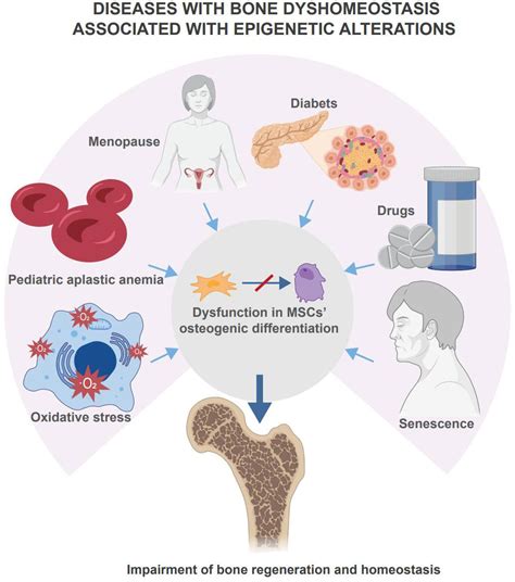 Frontiers | Epigenetic control of mesenchymal stem cells orchestrates bone regeneration