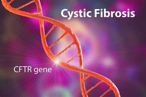 Cystic Fibrosis Etiology - Rare Disease Advisor