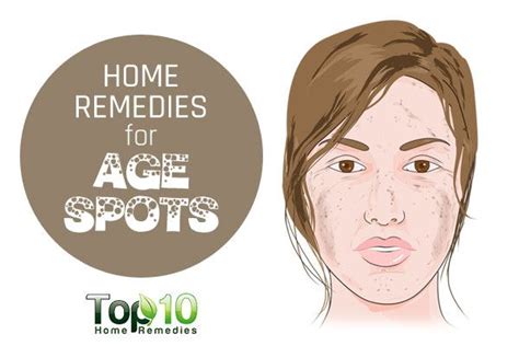 Home Remedies for Age Spots | Top 10 Home Remedies