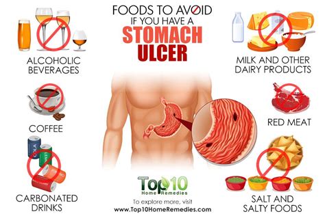 Foods to Avoid if You Have a Stomach Ulcer | Top 10 Home Remedies