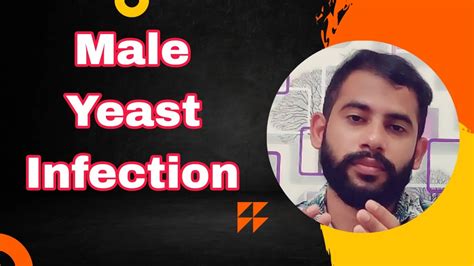Male yeast infection|Malayalam|Causes & Treatment - YouTube
