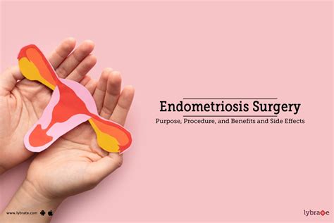 Endometriosis Surgery: Purpose, Procedure, Benefits and Side Effects