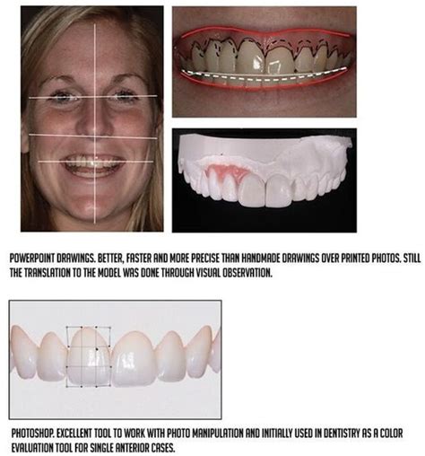 Discover the Evolution of Smile Design Techniques: A Comprehensive…