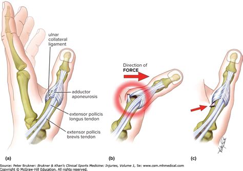 Anatomy Of The Thumb Ligaments 15900 | Hot Sex Picture