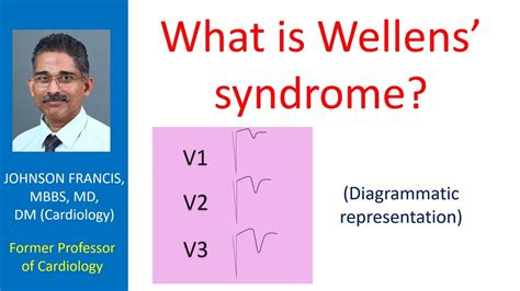 What is Wellens’ syndrome? - YouTube