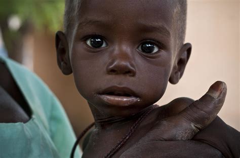 Acute malnourishment affects Niger's children | Poor rains a… | Flickr