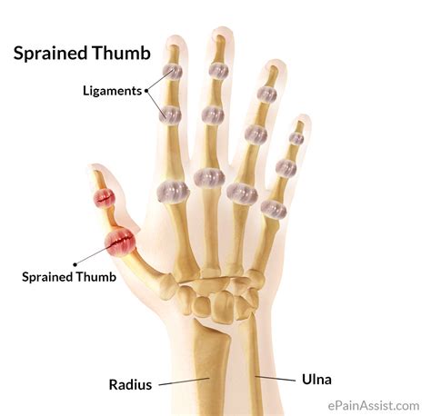 Thumb Pain|Causes|Symptoms|Treatment|Diagnosis