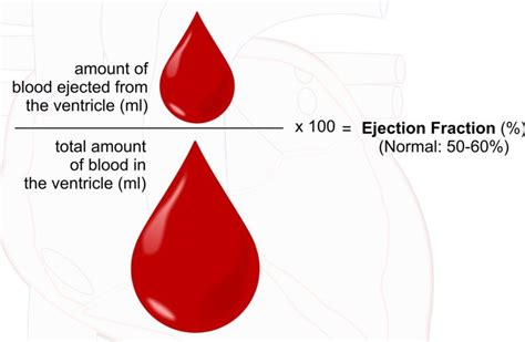 What’s a Normal Ejection Fraction for Elderly of Various Ages? » Scary Symptoms