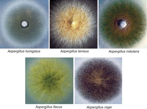 Aspergillus Fumigatus - Fungus Aspergillus Fumigatus Stock Image B250 0115 Science Photo Library ...