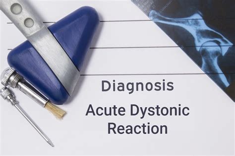 Acute Dystonic Reaction Causes, Symptoms, and Treatment - Facty Health