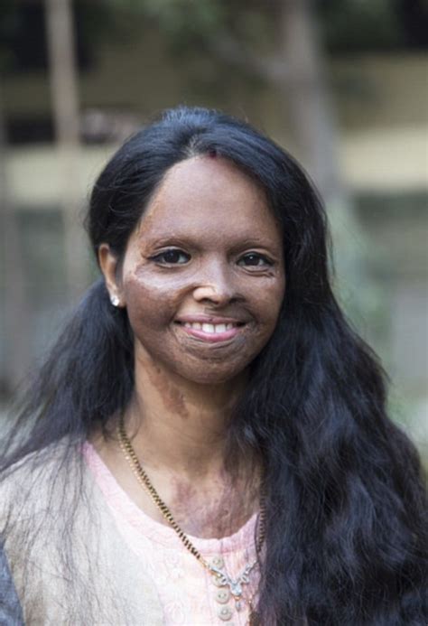 Inspiring Story Of Laxmi Agarwal, The Acid Attack Survivor Deepika Padukone Is Playing In Chhapaak