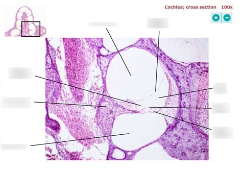 Cochlea Histology (100x) Diagram | Quizlet