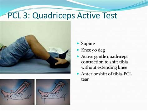 Knee Examination - PT Master Guide