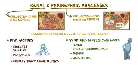 Urinary tract infections: Clinical: Video & Anatomy | Osmosis