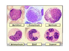 17 Hematology Slides ideas | hematology, medical lab technician, medical laboratory technician