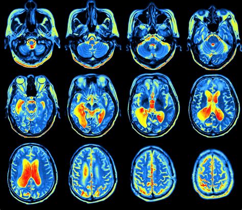 Nature versus nurture: how modern science is rewriting it - Mapping Ignorance