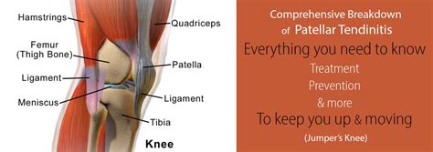 Patellar Tendonitis (Jumper's Knee) - Causes, Treatment & Prevention