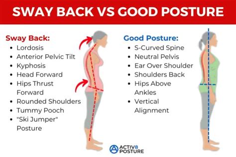 Sway Back - Activ8 Posture