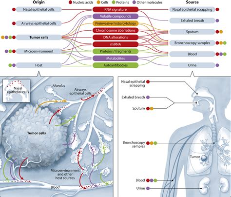 Biomarkers in Lung Cancer Screening: Achievements, Promises, and Challenges - Journal of ...