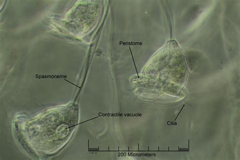 Vorticella Microscope