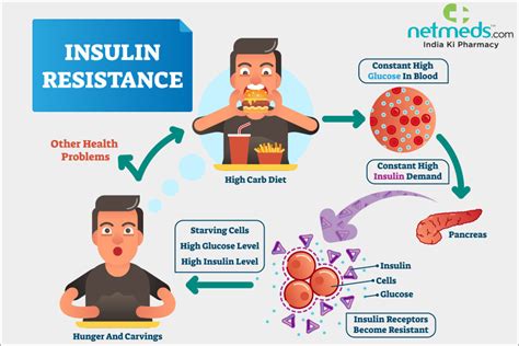 Insulin Resistance: Symptoms, Risk Factors, Diagnosis And Prevention