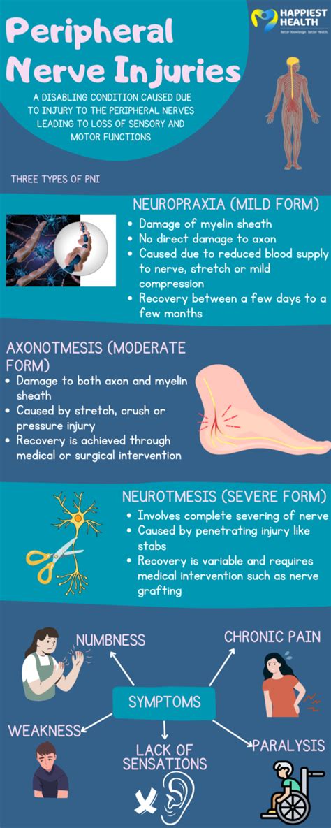 Types of peripheral nerve injuries | Happiest Health