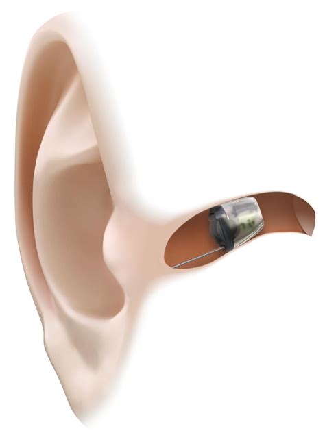 Hearing Aid Prices - UK - Phonak, Oticon, Widex, Resound...