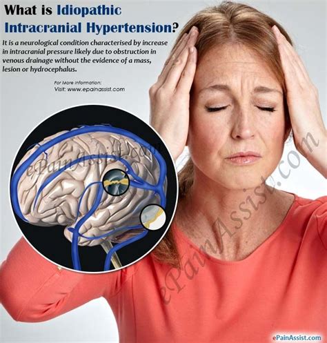 Idiopathic Intracranial Hypertension