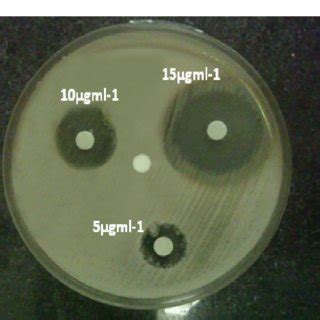 Microscopic observation of Streptococcus mutans biofilm inhibition. (a ...