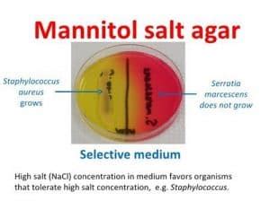 Mannitol Salt Agar - Plate, Test, Composition, Preparation, Uses ...