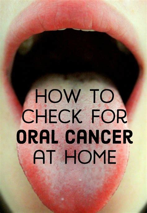 White Bump On Tongue Cancer