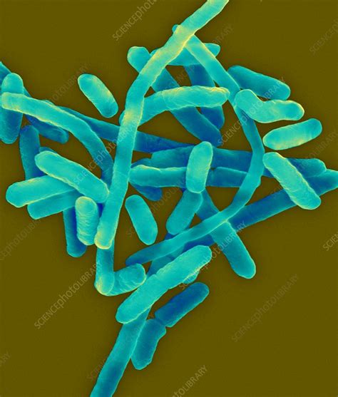 Citrobacter freundii, SEM - Stock Image - C032/2123 - Science Photo Library