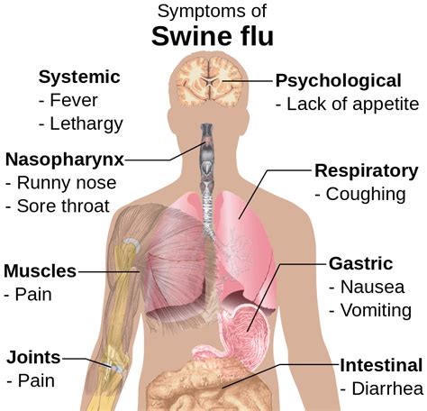 Flu (Influenza) — Symptoms and Treatment | Online Medical Library