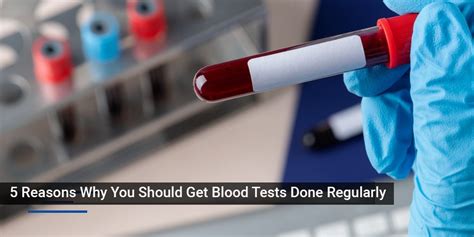 5 reasons why you should get blood tests done regularly