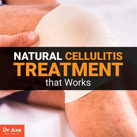 Cellulitis behandeling: Natural Remedies & Prevention Tips | Home Healthcare