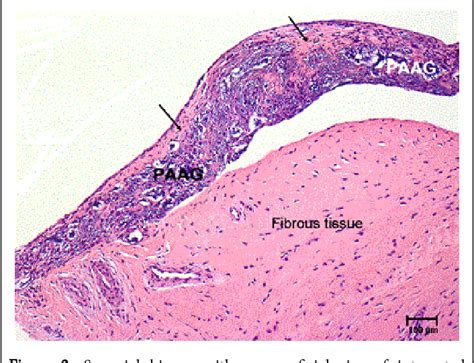 Figure 2 from Histological Appearance of the Synovial Membrane after ...