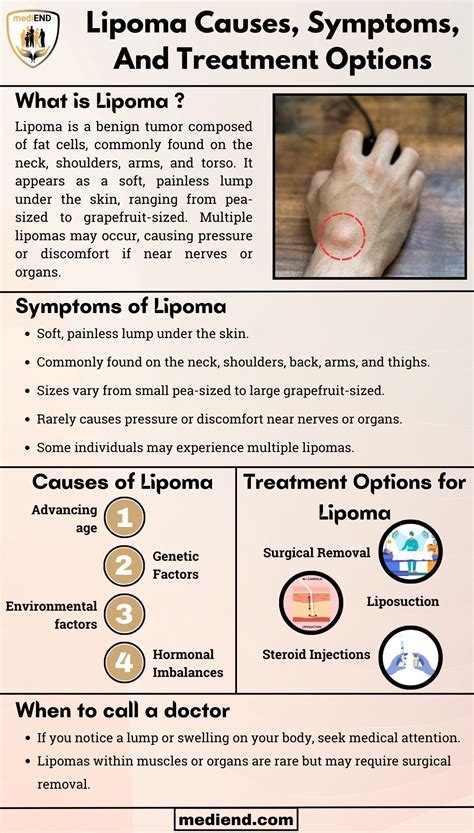 Lipoma Causes, Symptoms, And Effective Prevention Methods - MediEnd ...