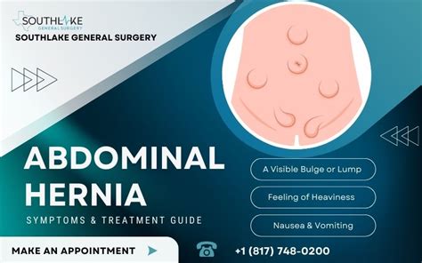 Abdominal Hernia: Symptoms & Treatment Options - Southlake General Surgery