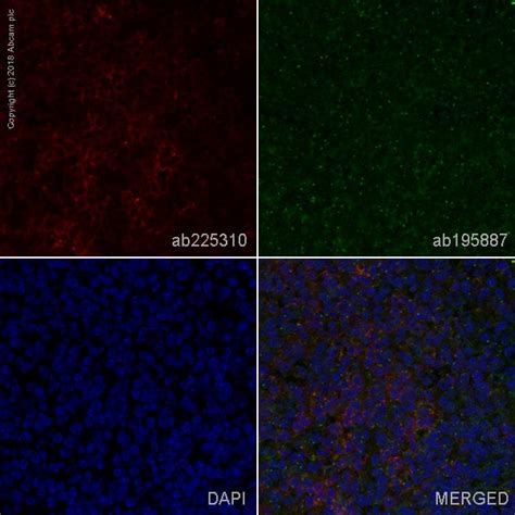 Alexa Fluor® 647 Anti-CD4 antibody [EPR19514] (ab225310) | Abcam