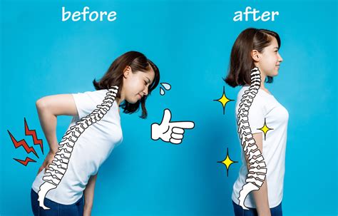 Posture Perfect: How To Correct Your Back Pain | Ottawa Health Group