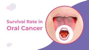 Survival Rate of Oral Cancer by Age | Dr. Amit Chakraborty