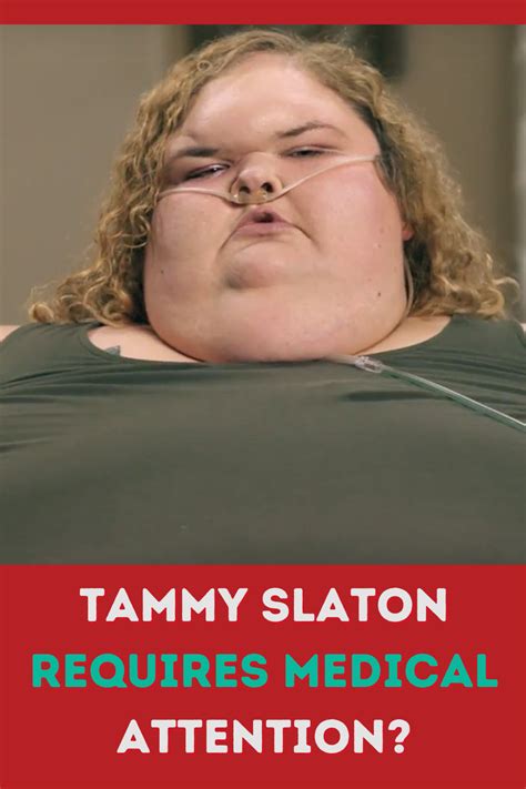 1000 Lb Sisters: Tammy Slaton Requires Medical Attention? Needs To Be ...