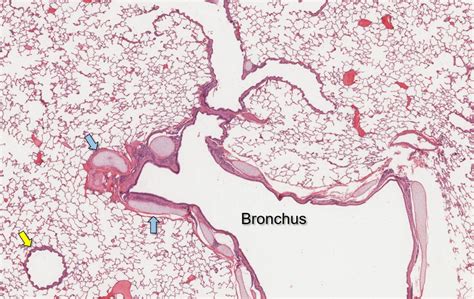 Air conduction: Larynx, Trachea, Bronchi and Bronchioles – Veterinary Histology