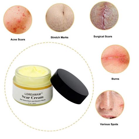 Acne Scar Removal Cream,Scar Cream,Scar Gel,Skin Repair Cream,Treatment ...